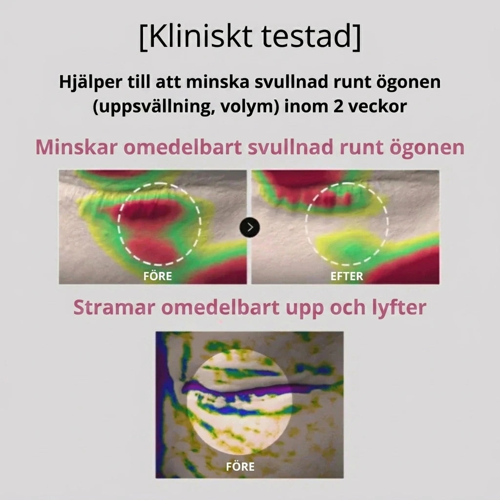 Peptid- och kollagenbaserade hydrogelögonplåster