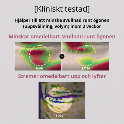 Peptid- och kollagenbaserade hydrogelögonplåster